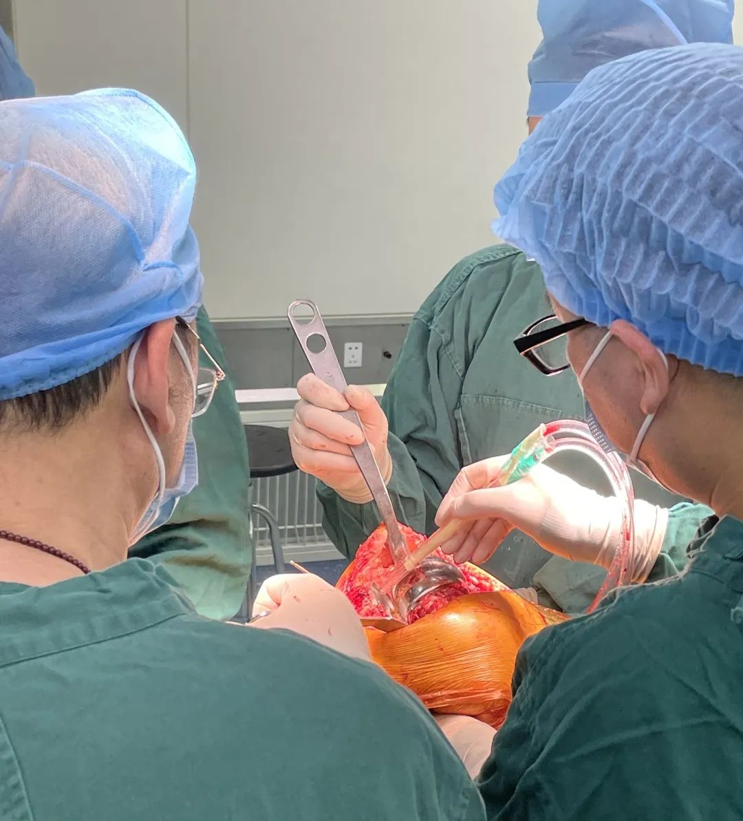 重塑“膝”望——我院成功完成首例“人工膝关节翻修术”